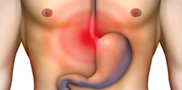 Üst Solunum Yolu Enfeksiyonu Tedavisi