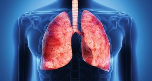 Akciğer Enfeksiyonu Tedavisi