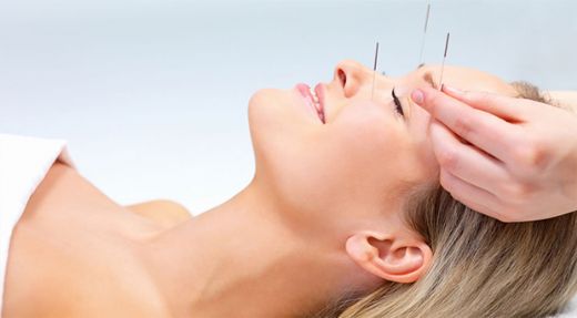 Akupunktur Tedavisi